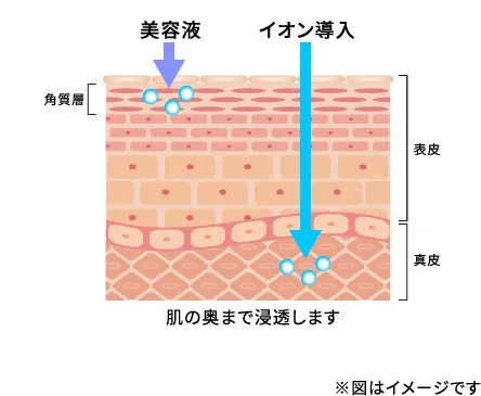 画像：美白・美肌効果のイオン導入