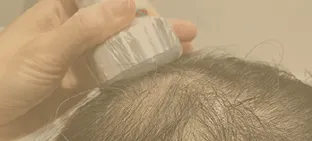 画像：ゲロッティ プロ スカルプ使用イメージ